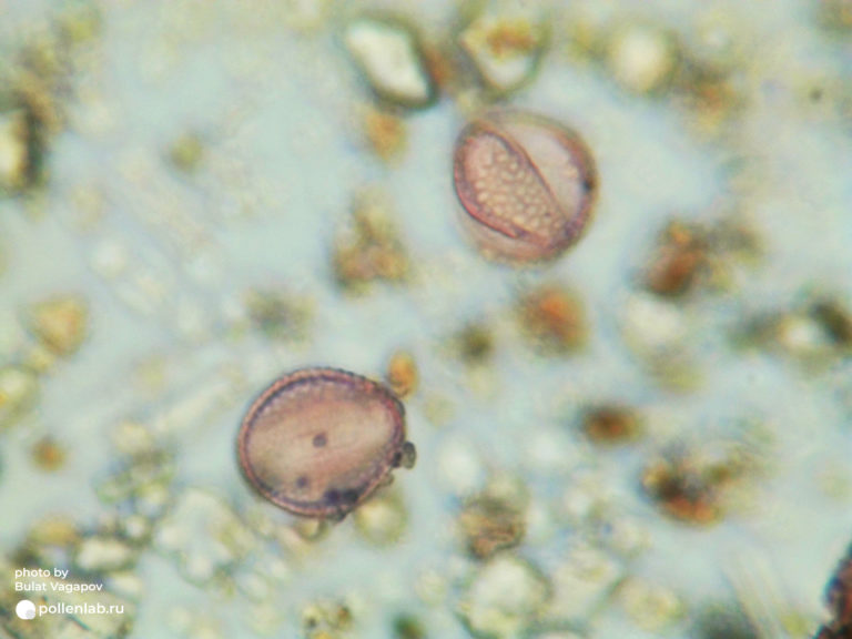 Artemisia pollen_2 (pollenlab.ru)