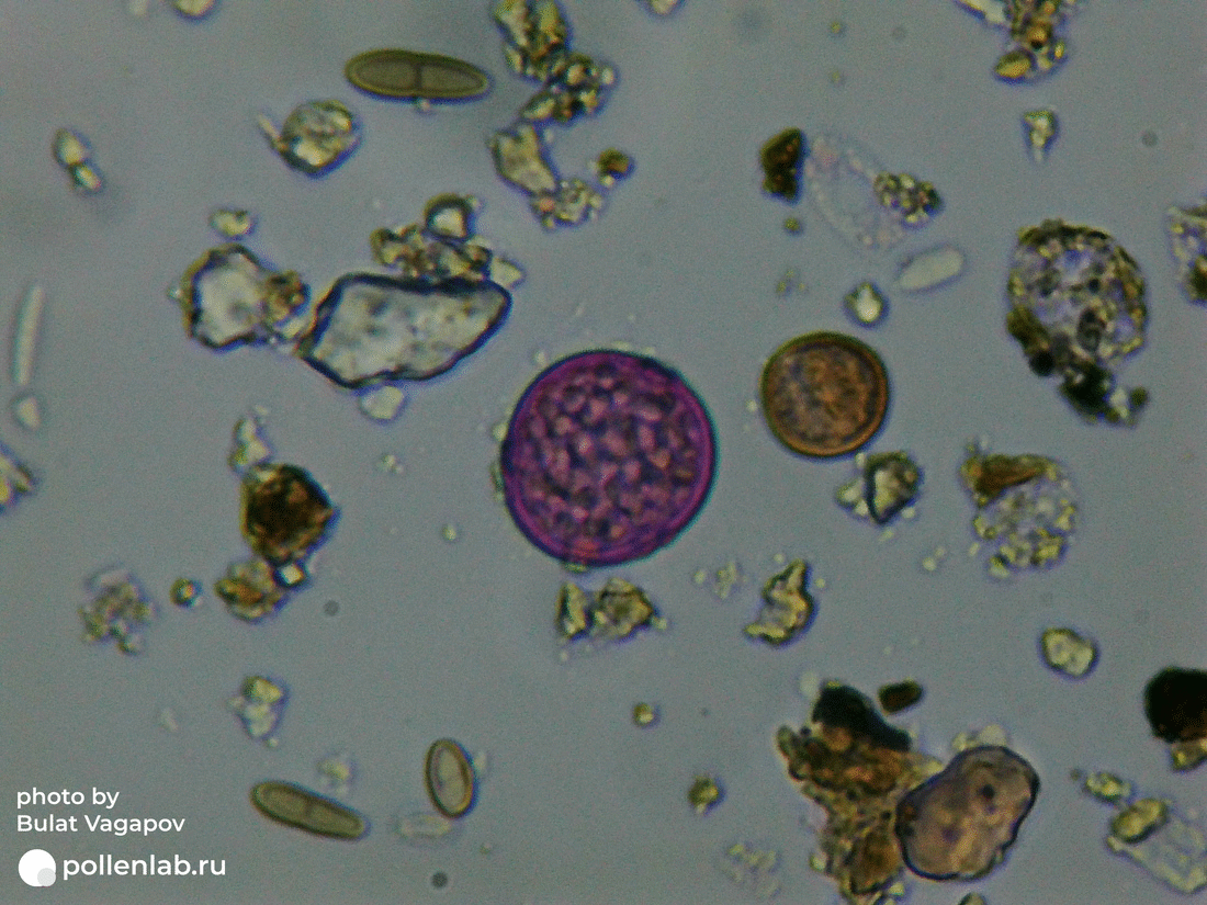 Rumex pollen (pollenlab.ru)